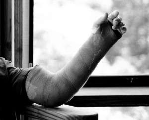 Broken arm accident injury
