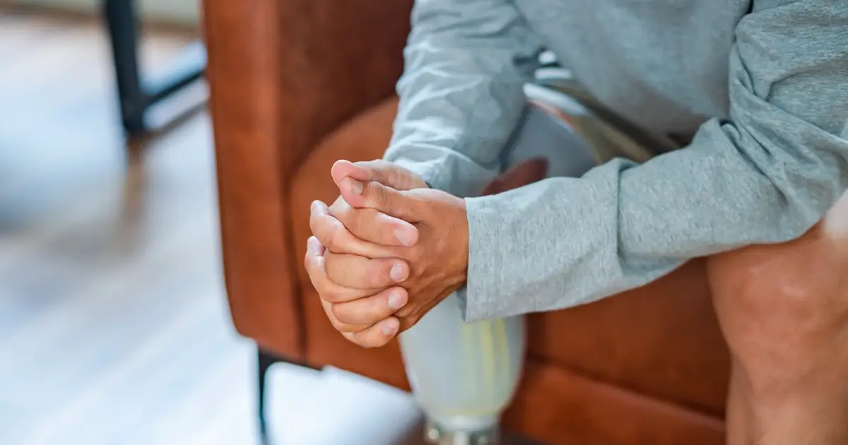 Amputation Injuries